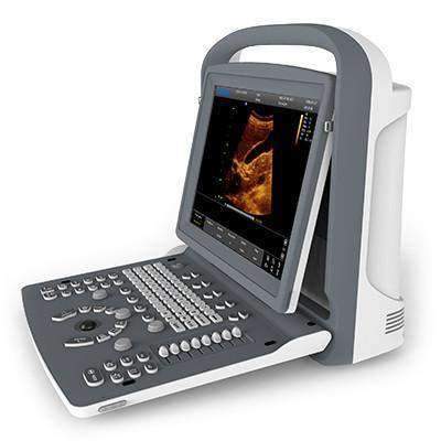 CHISON ECO 3 Portable Ultrasound Machine