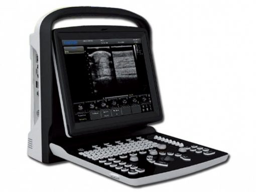 Chison ECO 1 Portable Ultrasound machine
