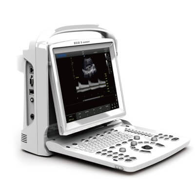 Chison ECO 3 Expert Portable Ultrasound machine