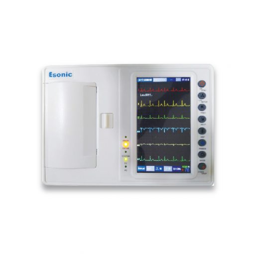 Esonic 6 Channel Digital Electrocardiograph ECG Machine